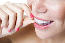 Reguleringsskinner for å rette tennene uten klosser og streng