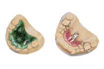  Avtagbare plater som brukes som innledende behandling for å forebygge tann- og kjevestillingsfeil 