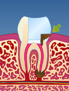 Fig VIII