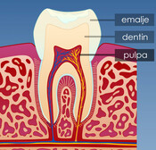 Illustrasjon av tannens oppbygning